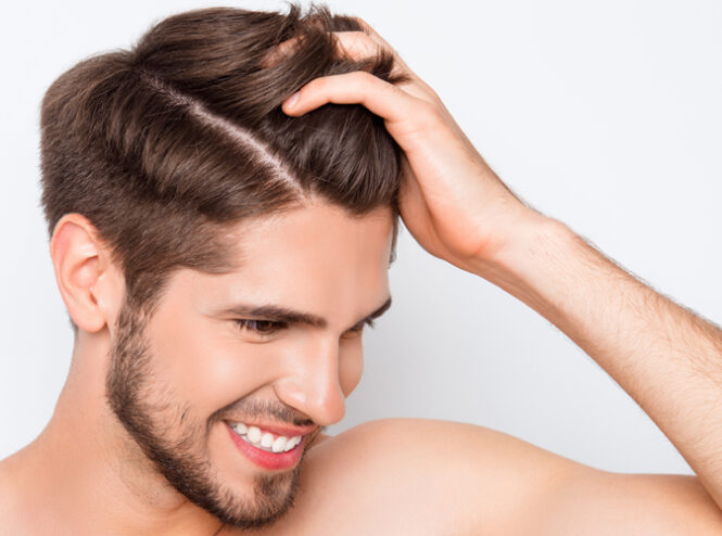 Greffe de cheveux FUE