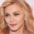 Madonna chirurgie esthetique
