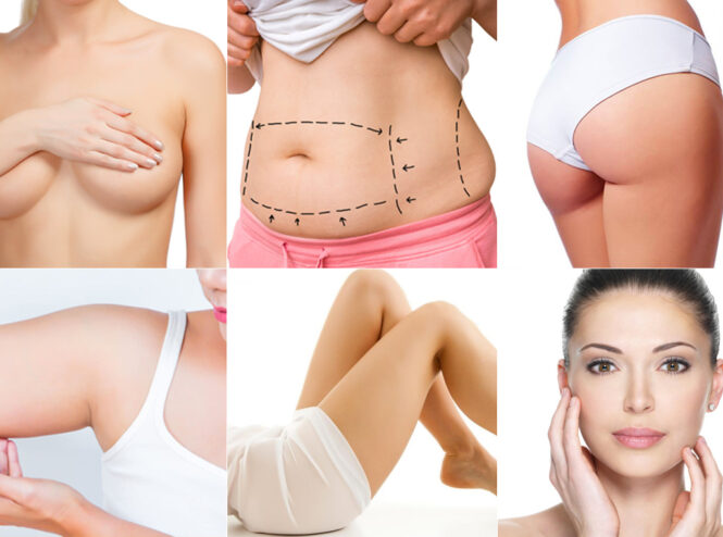Types de Chirurgie Esthétique