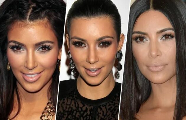 Kim-Kardashian-Rhinoplastie