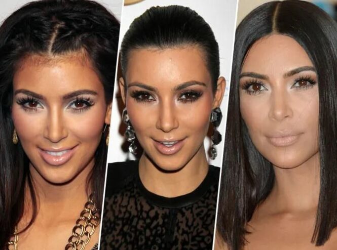 Kim-Kardashian-Rhinoplastie