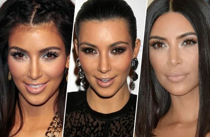 Kim-Kardashian-Rhinoplastie